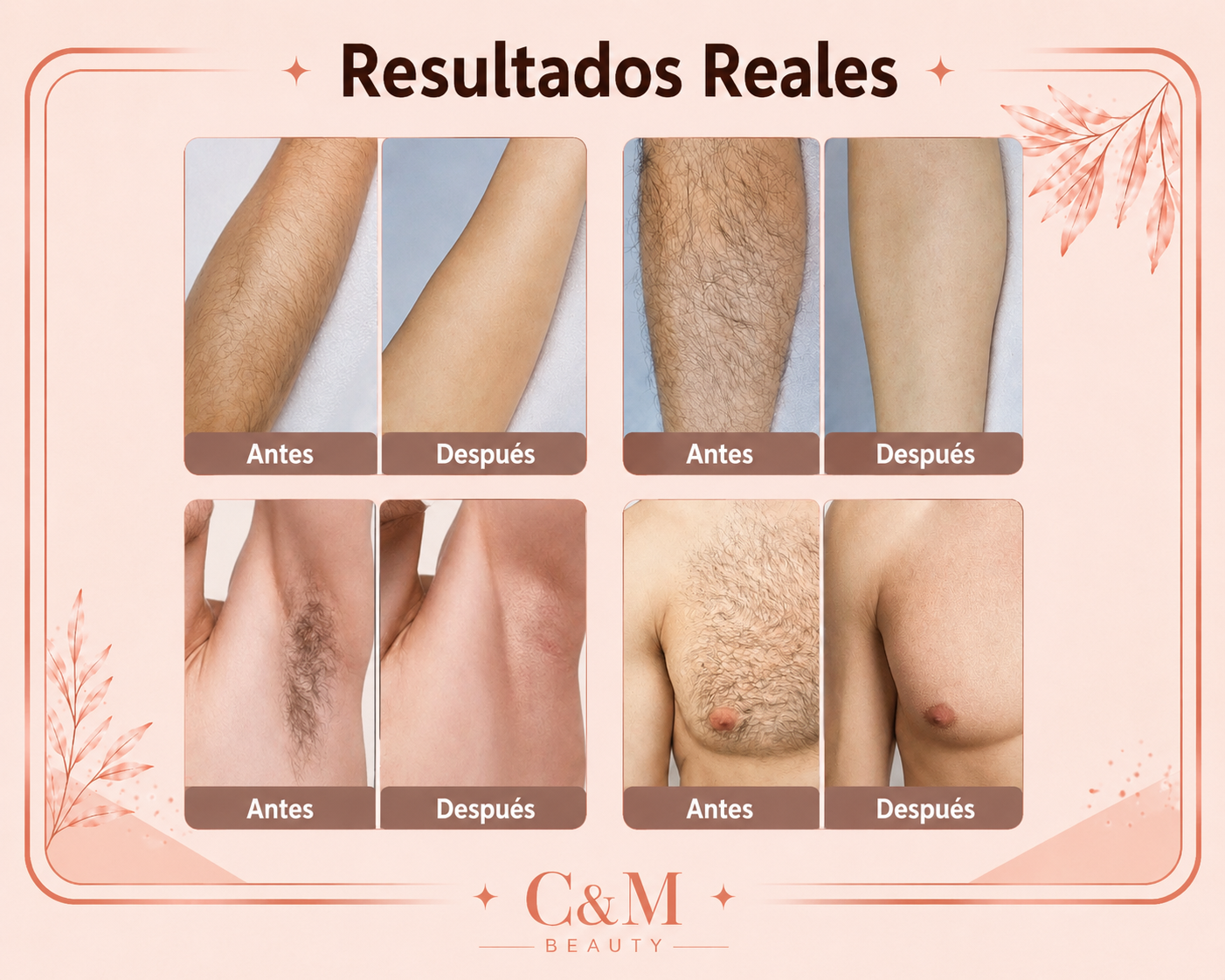 Resultados reales antes y después de la depiladora IPL en brazos, piernas y axilas - CYM
