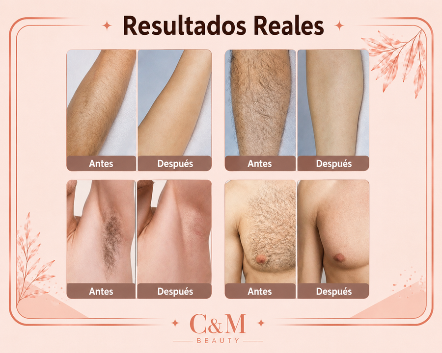 Resultados reales antes y después de la depiladora IPL en brazos, piernas y axilas - CYM